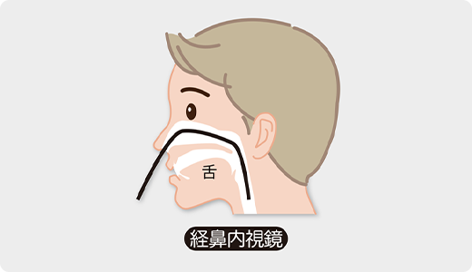 経鼻内視鏡