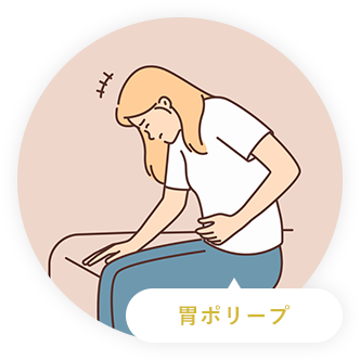 胃ポリープ