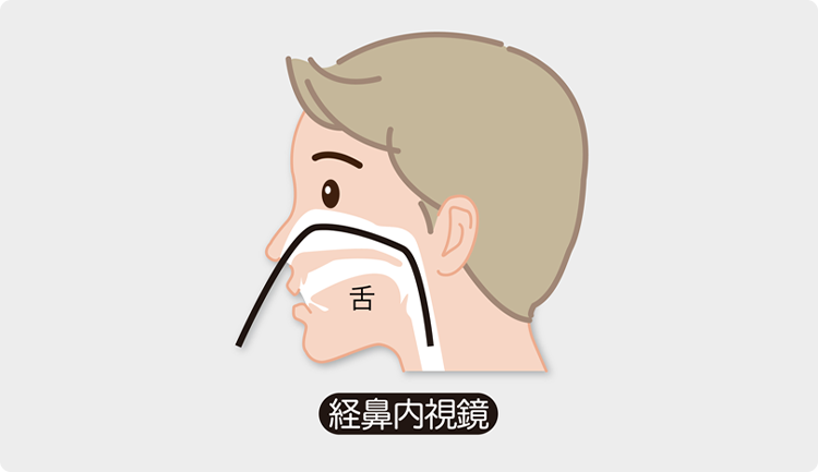 経鼻内視鏡