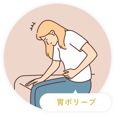 胃ポリープ
